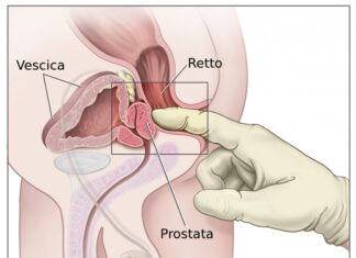IL MASSAGGIO ALLA PROSTATA: COME FARLO