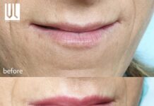 Trucco permanente labbra by Viktoria Logoida