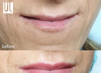 Trucco permanente labbra by Viktoria Logoida