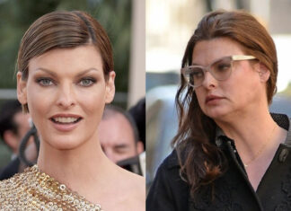 Linda Evangelista: sfigurata dalla CoolSculpting, mi ha rovinato la vita